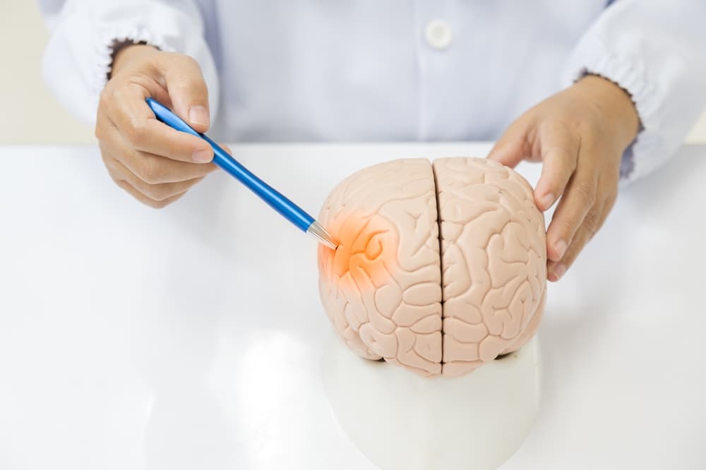 A neurologist's hand points to a human brain anatomy model, highlighting a lesion on a white background. 