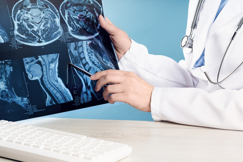 A doctor reviews spinal MRI scans on film, pointing at specific areas, highlighting medical examination for spinal injuries.